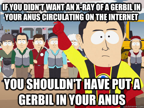 if you didn't want an x-ray of a gerbil in your anus circulating on the internet you shouldn't have put a gerbil in your anus - if you didn't want an x-ray of a gerbil in your anus circulating on the internet you shouldn't have put a gerbil in your anus  Captain Hindsight