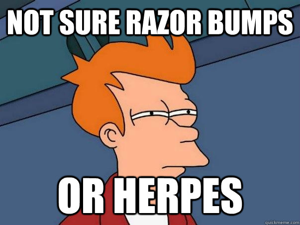 not sure razor bumps or herpes  Not sure Fry