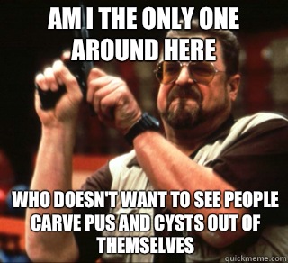 AM I THE ONLY ONE AROUND HERE Who doesn't want to see people carve pus and cysts out of themselves  an I the only one around here