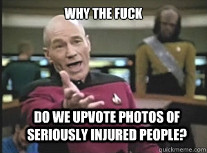 why the fuck do we upvote photos of seriously injured people?  Annoyed Picard