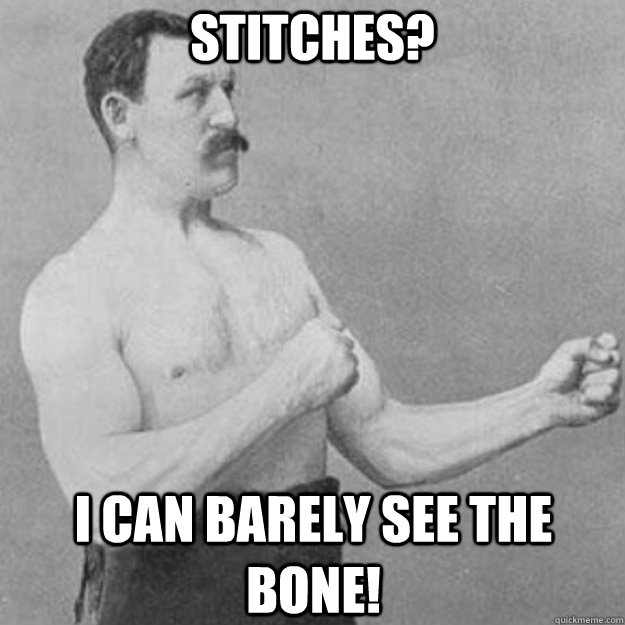 Stitches? I can barely see the bone! - Stitches? I can barely see the bone!  overly manly man