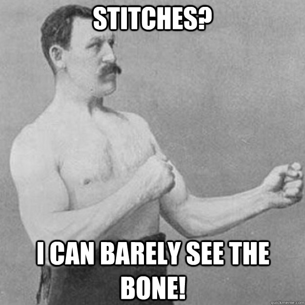 Stitches? I can barely see the bone!  overly manly man