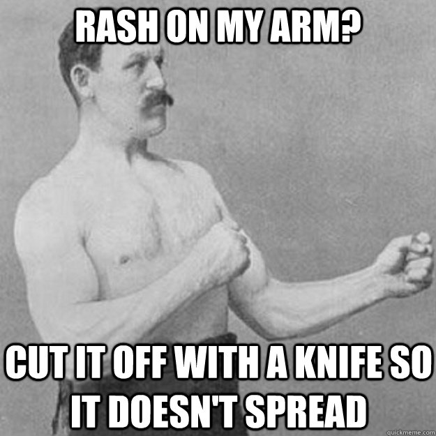 RASH ON MY ARM? CUT IT OFF WITH A KNIFE SO IT DOESN'T SPREAD  overly manly man