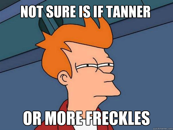 not sure is if tanner or more freckles  Futurama Fry