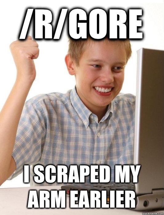 /R/GORE I scraped my arm earlier  First Day on the Internet Kid