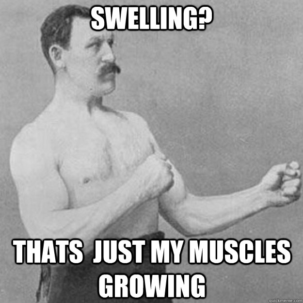 SWELLING? THATS  JUST MY MUSCLES GROWING  overly manly man