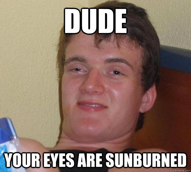 dude Your eyes are sunburned  10 Guy