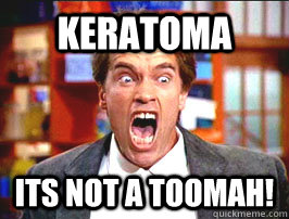 Keratoma ITS NOT A TOOMAH!   