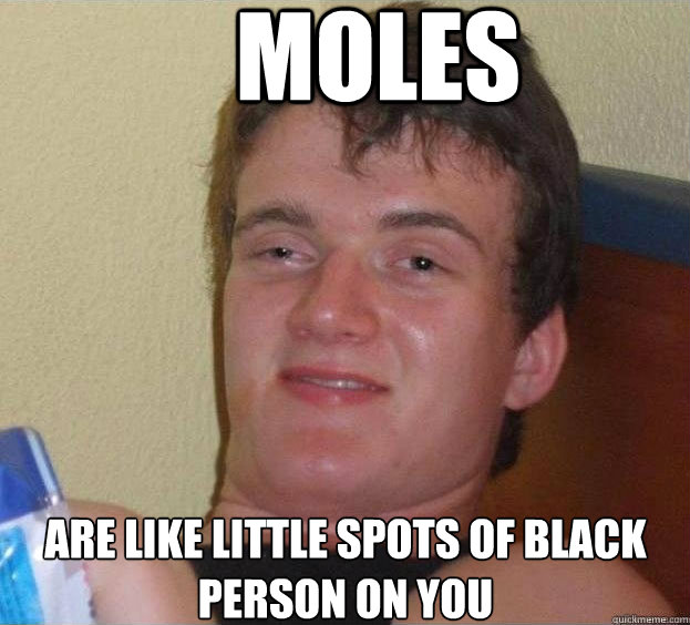 moles are like little spots of black person on you  - moles are like little spots of black person on you   The High Guy