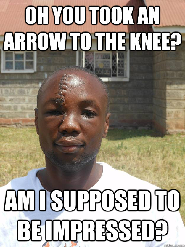 Oh you took an arrow to the knee? Am I supposed to be impressed? - Oh you took an arrow to the knee? Am I supposed to be impressed?  GOOD GUY OMARI