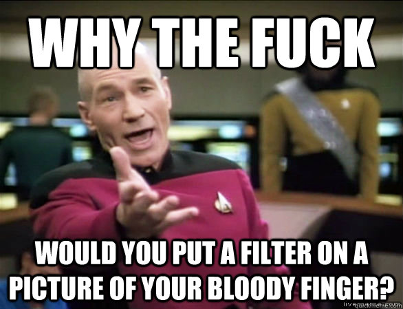 Why the fuck Would you put a filter on a picture of your bloody finger?  Annoyed Picard HD