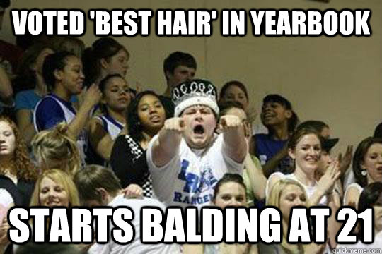 voted 'best hair' in yearbook starts balding at 21  