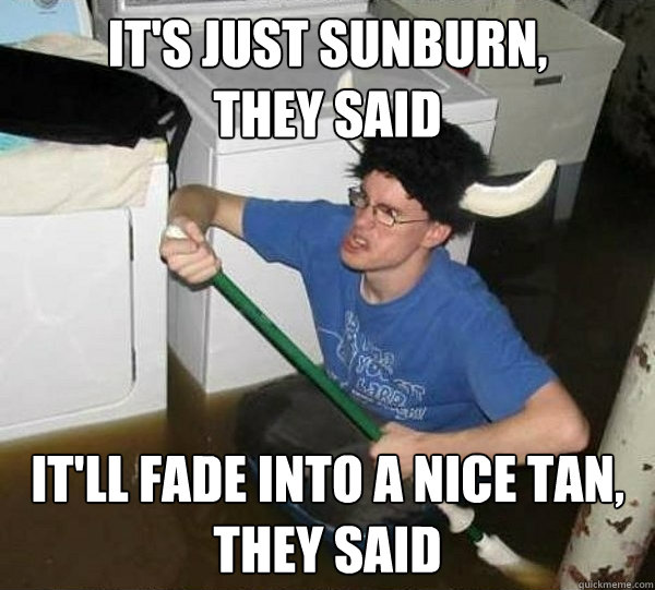 It's just sunburn, 
they said It'll fade into a nice tan, they said - It's just sunburn, 
they said It'll fade into a nice tan, they said  They said