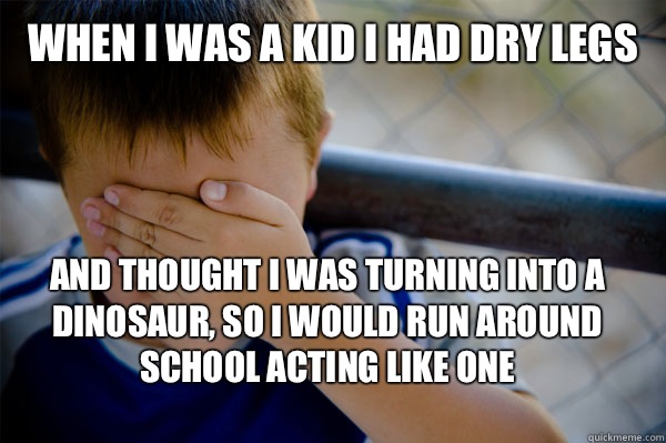WHEN I WAS A KID I HAD DRY LEGS And thought I was turning into a dinosaur, so I would run around school acting like one  Confession kid