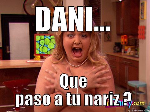 DANI... QUE PASO A TU NARIZ ? Misc