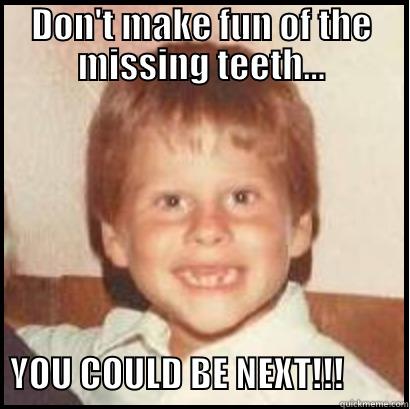 Rob 1978 No Teeth No Problem - DON'T MAKE FUN OF THE MISSING TEETH...         YOU COULD BE NEXT!!!         Misc