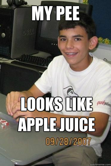 My pee looks like apple juice - My pee looks like apple juice  Misc