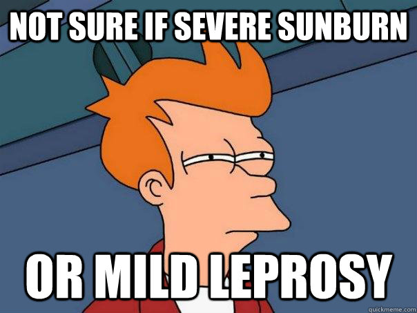 not sure if severe sunburn or mild leprosy   Futurama Fry