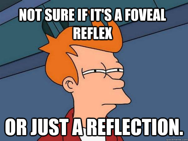 Not sure if it's a foveal reflex or just a reflection.  Futurama Fry