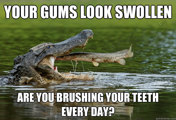 your gums look swollen are you brushing your teeth every day? - your gums look swollen are you brushing your teeth every day?  Dentist Fish
