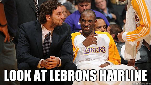  look at lebrons hairline -  look at lebrons hairline  kobe bryant 24