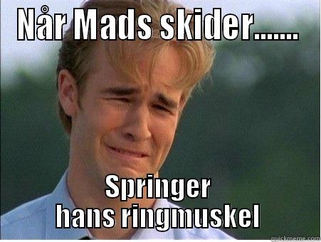 NÅR MADS SKIDER....... SPRINGER HANS RINGMUSKEL 1990s Problems