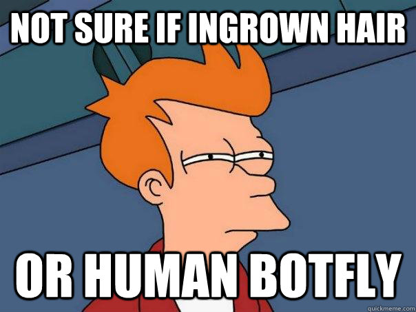 Not sure if ingrown hair Or human botfly  Futurama Fry