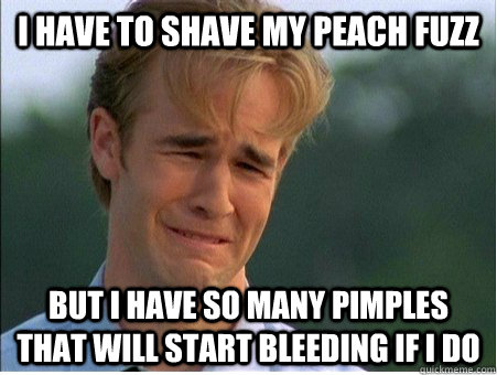 I have to shave my peach fuzz But i have so many pimples that will start bleeding if i do  1990s Problems