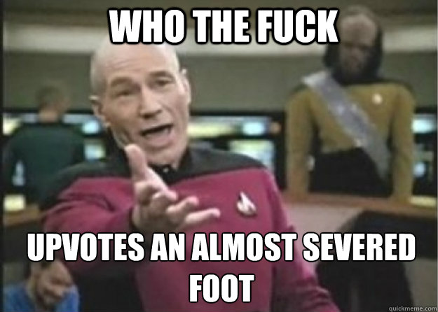 who the fuck upvotes an almost severed foot  Annoyed Pichard