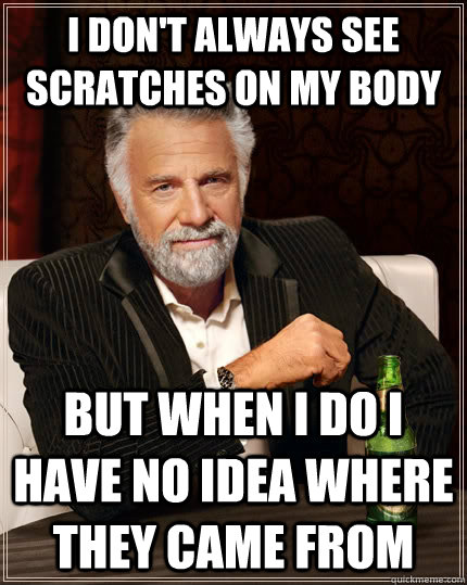 I don't always see scratches on my body but when I do I have no idea where they came from  The Most Interesting Man In The World