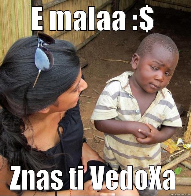 E MALAA :$ ZNAS TI VEDOXA Skeptical Third World Kid