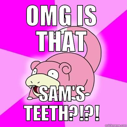 OMG IS THAT SAM>! - OMG IS THAT SAM'S TEETH?!?! Slowpoke