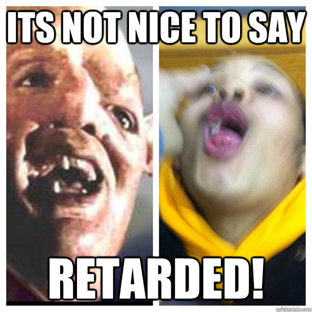 Its not nice to say Retarded!  Niggas be like