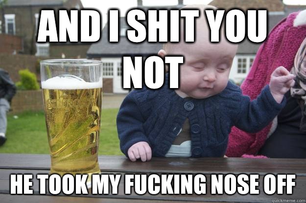 And I shit you not He took my fucking nose off  drunk baby