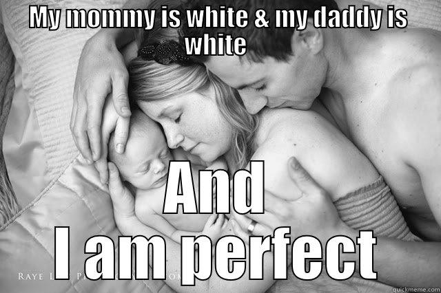 MY MOMMY IS WHITE & MY DADDY IS WHITE  AND I AM PERFECT Misc