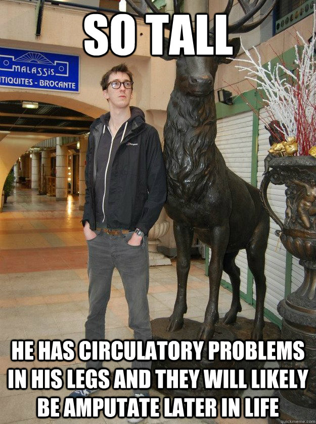So tall he has circulatory problems in his legs and they will likely be amputate later in life - So tall he has circulatory problems in his legs and they will likely be amputate later in life  Really Tall Redditor