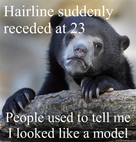 Hairline suddenly 
receded at 23
 People used to tell me I looked like a model - Hairline suddenly 
receded at 23
 People used to tell me I looked like a model  Confession Bear