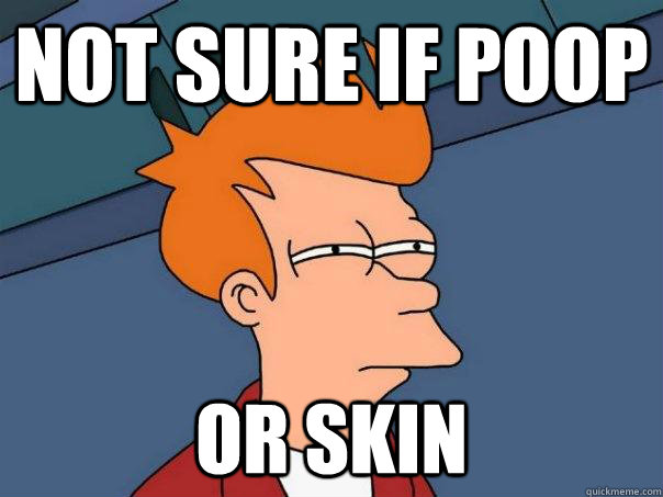 Not sure if poop Or skin  Futurama Fry