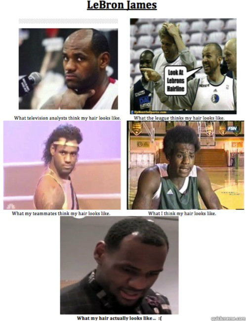   -    LeBron James Receding Hairline