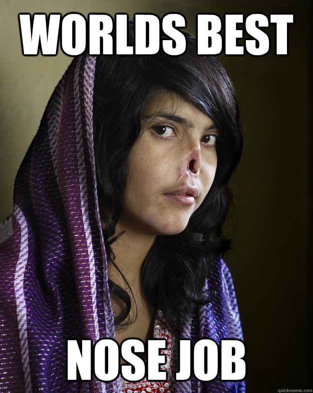 worlds best nose job - worlds best nose job  random meme