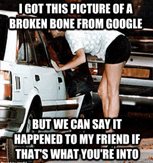 i got this picture of a broken bone from google but we can say it happened to my friend if that's what you're into  Karma Whore