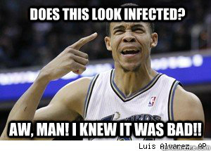 Does this look infected? Aw, man! I knew it was bad!!  JaVale McGee