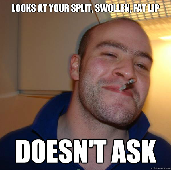 Looks at your split, swollen, fat lip Doesn't ask  - Looks at your split, swollen, fat lip Doesn't ask   Misc