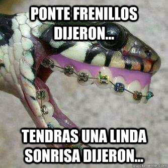 Ponte frenillos dijeron... Tendras una linda sonrisa dijeron...  culebra