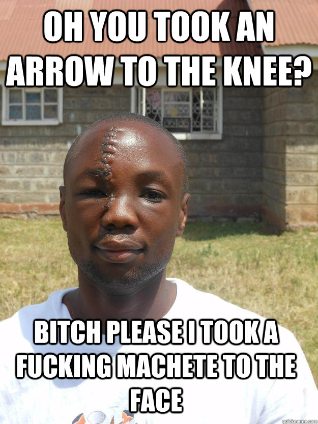 Oh you took an arrow to the knee? bitch please I took a fucking machete to the face  GOOD GUY OMARI