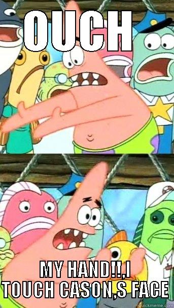 OUCH  MY HAND!!,I TOUCH CASON,S FACE Push it somewhere else Patrick