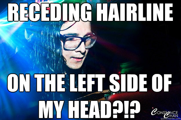   Receding hairline  on the left side of my head?!?   Dubstep Oblivious Skrillex