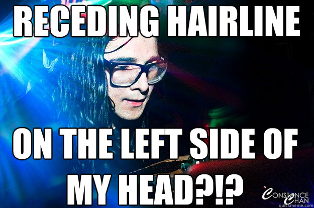   Receding hairline  on the left side of my head?!?   Dubstep Oblivious Skrillex