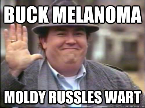 buck melanoma moldy russles wart  uncle buck