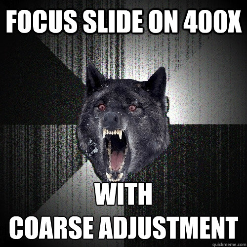 FOCUS SLIDE ON 400x with
coarse adjustment  Insanity Wolf